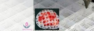 BS3.1 prints a medical-grade PCL (120,000 Dalton – supplied by Corbion PURAC) scaffold to reconstruct the shape and volume of a female breast after mastectomy. Tissue is regenerated by injecting patient-derived fat cells into the scaffold pores (see inset). Research project by BellaSeno GmbH
