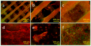 Fluorescence microscope images (a–f) of the actin cytoskeleton (red) and the cell nuclei (green) of ST2 cells in a PCL-PEG ADA-GEL construct after 28 days of incubation of different magnification: (a,b) overview images; (c) densely packed area of the cells covering both materials; (d) cell morphology on the hard phase; (e) cell agglomerate and spread single cells in hydrogel; and (f) densely packed area of cells (hydrogel phase) [1]