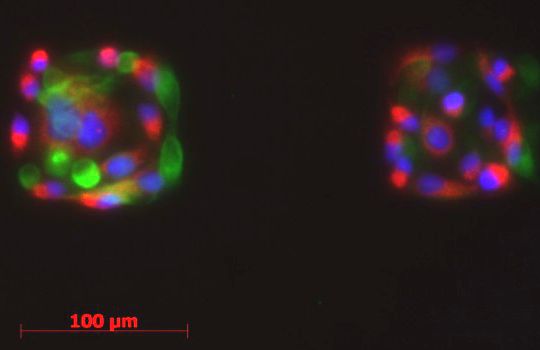 Fluorescence Image – Green: β-tubulin-II neuronal marker; Red: GFAP; Blue: Cell nuklei