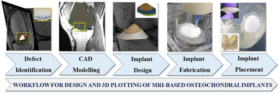 The GeSiM BioScaffold Printer BS3.1 was used for implant manufacturing (Step 4). The software of the instrument sliced the original STL data and defined parameters for the inner porosity.