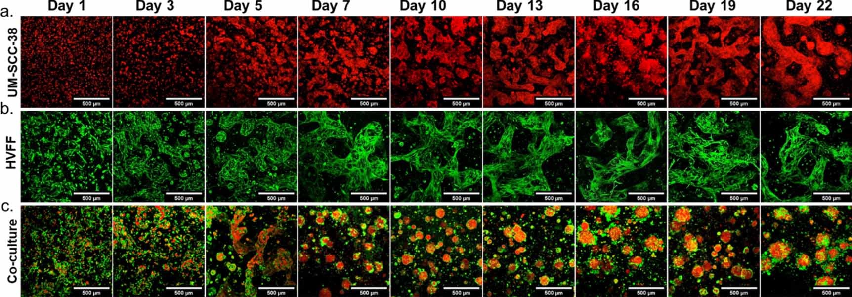 Taken from Fig 2. Three-dimensional bioprinted cultures of cells encapsulated in A1.5G5dECMT. Cells were encapsulated in A1.5G5dECMT and bioprinted into discs with 5 mm diameter and 500 μm height. (a). Transduced RFP-UM-SCC-38. (b). HVFFs stained with Calcein-AM c. 2:1 Co-culture of HVFF: RFP-UM-SCC-38. Red: UM-SCC-38, Green: HVFF. Scalebar 500 μm. Z-stack maximum intensity projection.