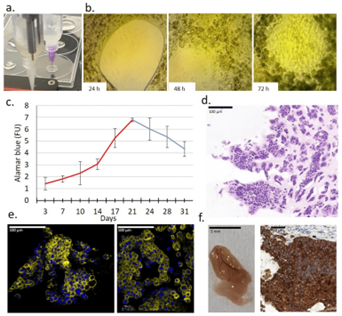 Taken from Fig 3. Characteristics of a new 3D bioprinted tissue-mimetic model of ZR75.1 human cancer cells. (a) Two dispenser units operated individually for constructing 3D bioprinted tissue-mimetic structures.